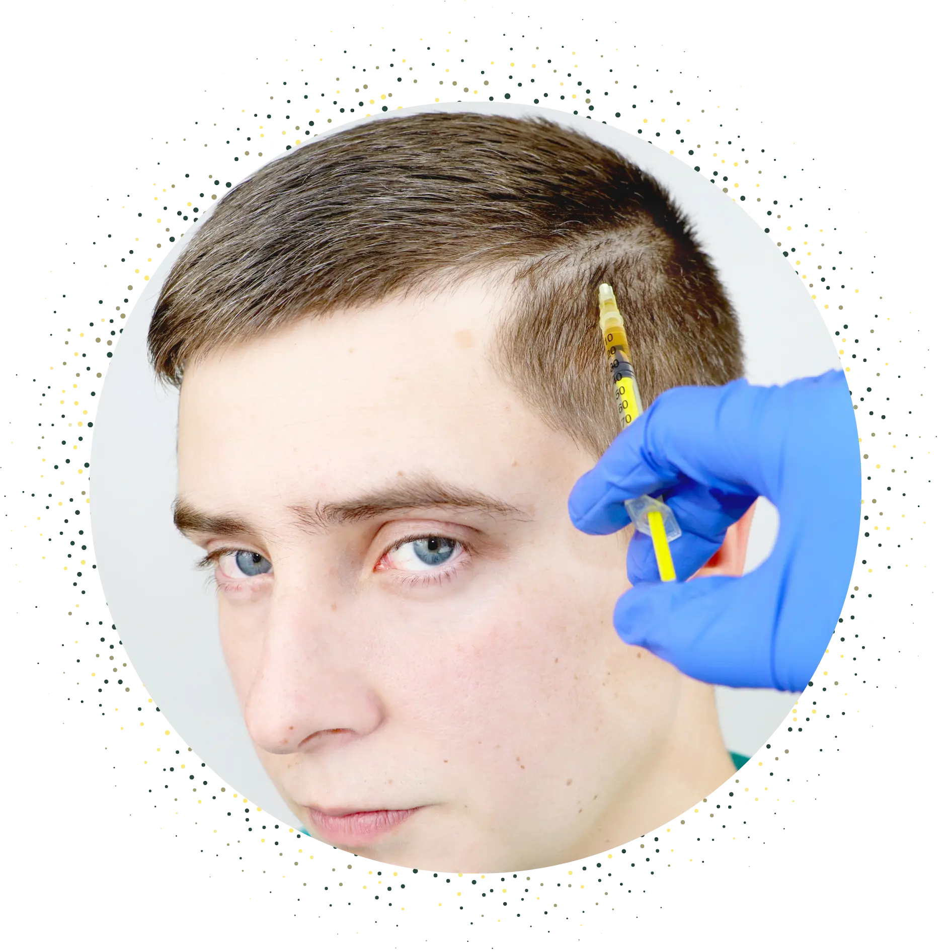 Mesotherapie (1)