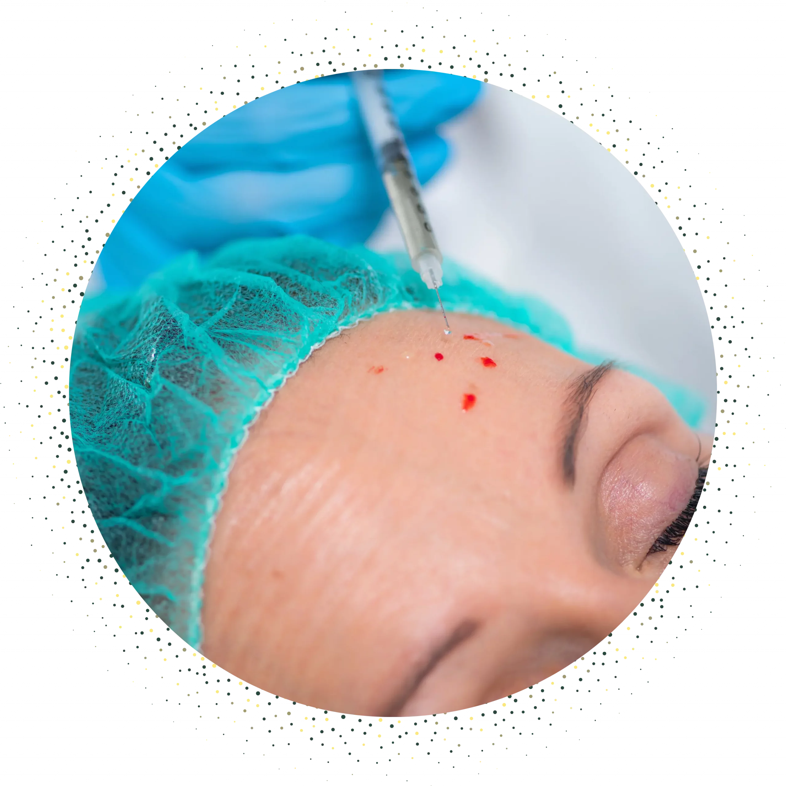 PRP-Behandlung (Plättchenreiches Plasma)